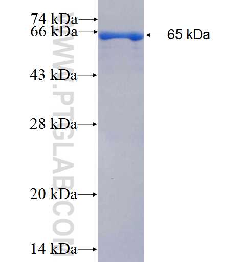 KIF3A fusion protein Ag4954 SDS-PAGE
