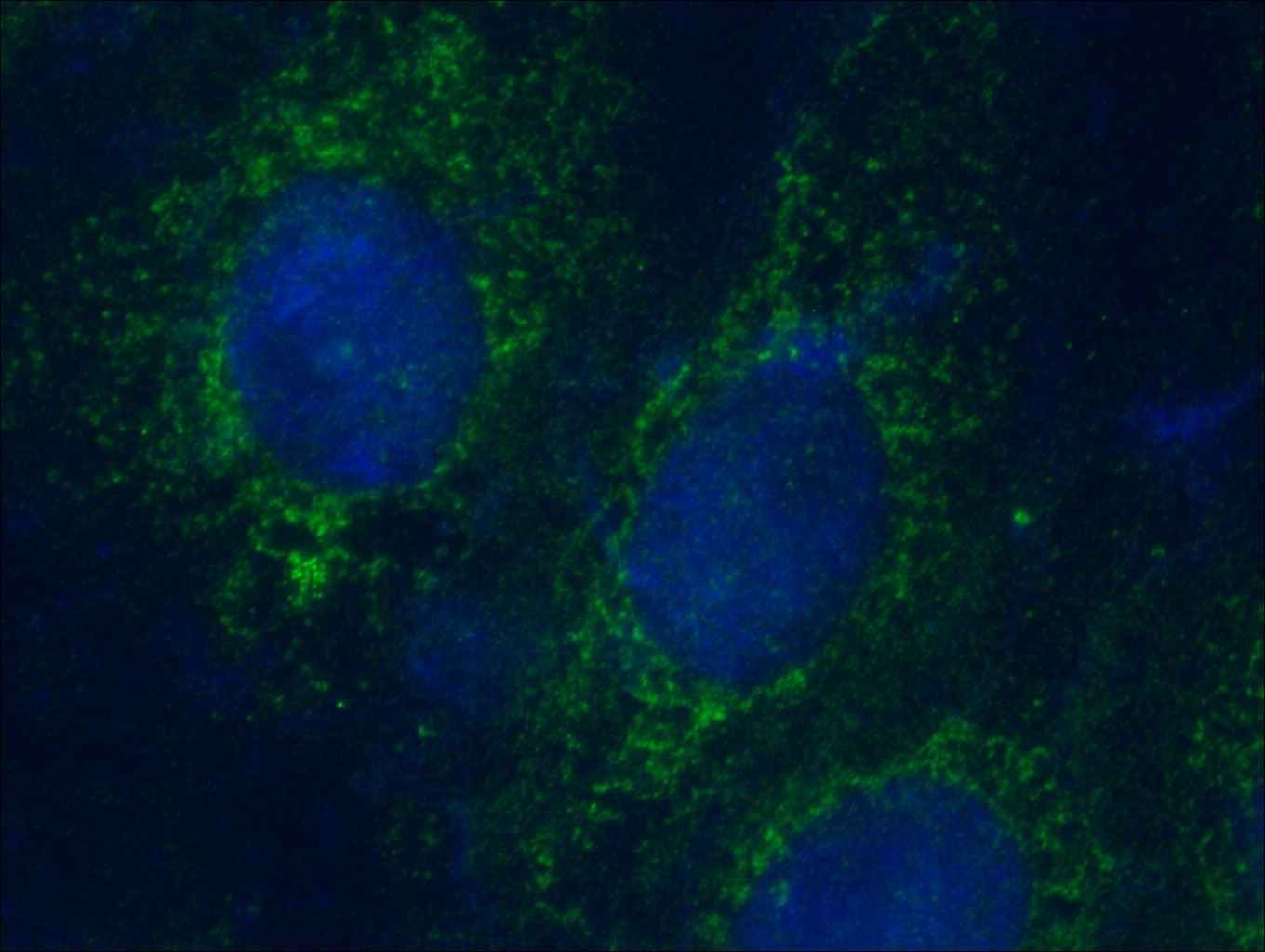 Immunofluorescence (IF) / fluorescent staining of SH-SY5Y cells using KIF3C Polyclonal antibody (14333-1-AP)