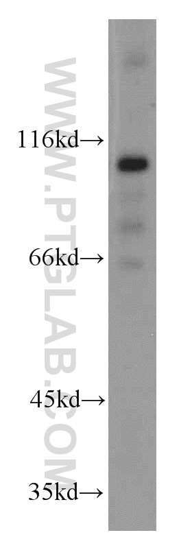 WB analysis of mouse brain using 14333-1-AP