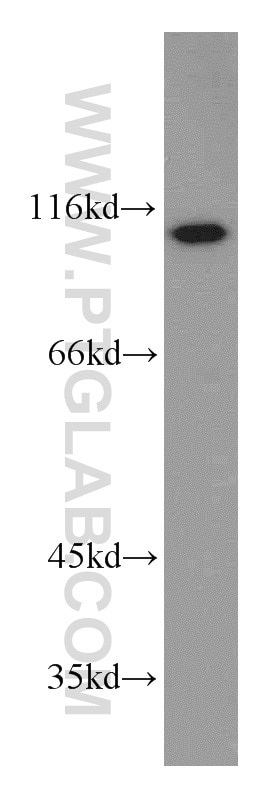 WB analysis of HeLa using 14333-1-AP