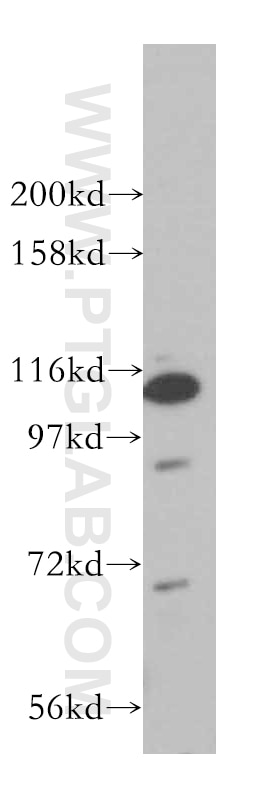 Western Blot (WB) analysis of Y79 cells using KIF3C Polyclonal antibody (14333-1-AP)