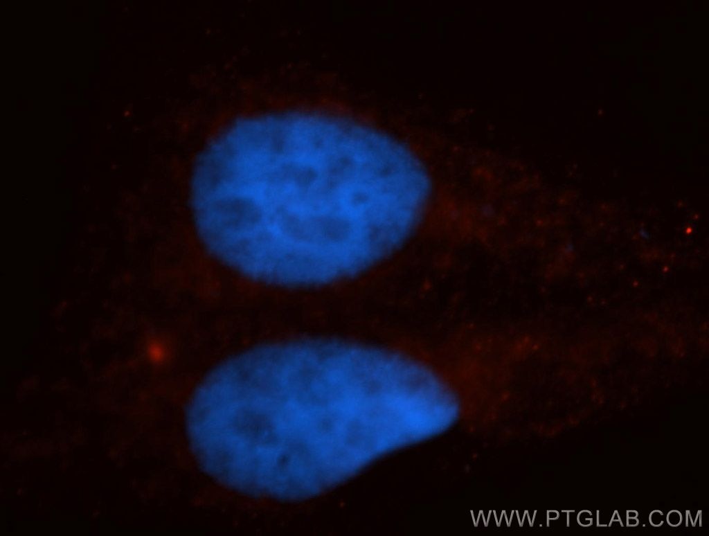 Immunofluorescence (IF) / fluorescent staining of HepG2 cells using KIF4A Polyclonal antibody (14344-1-AP)