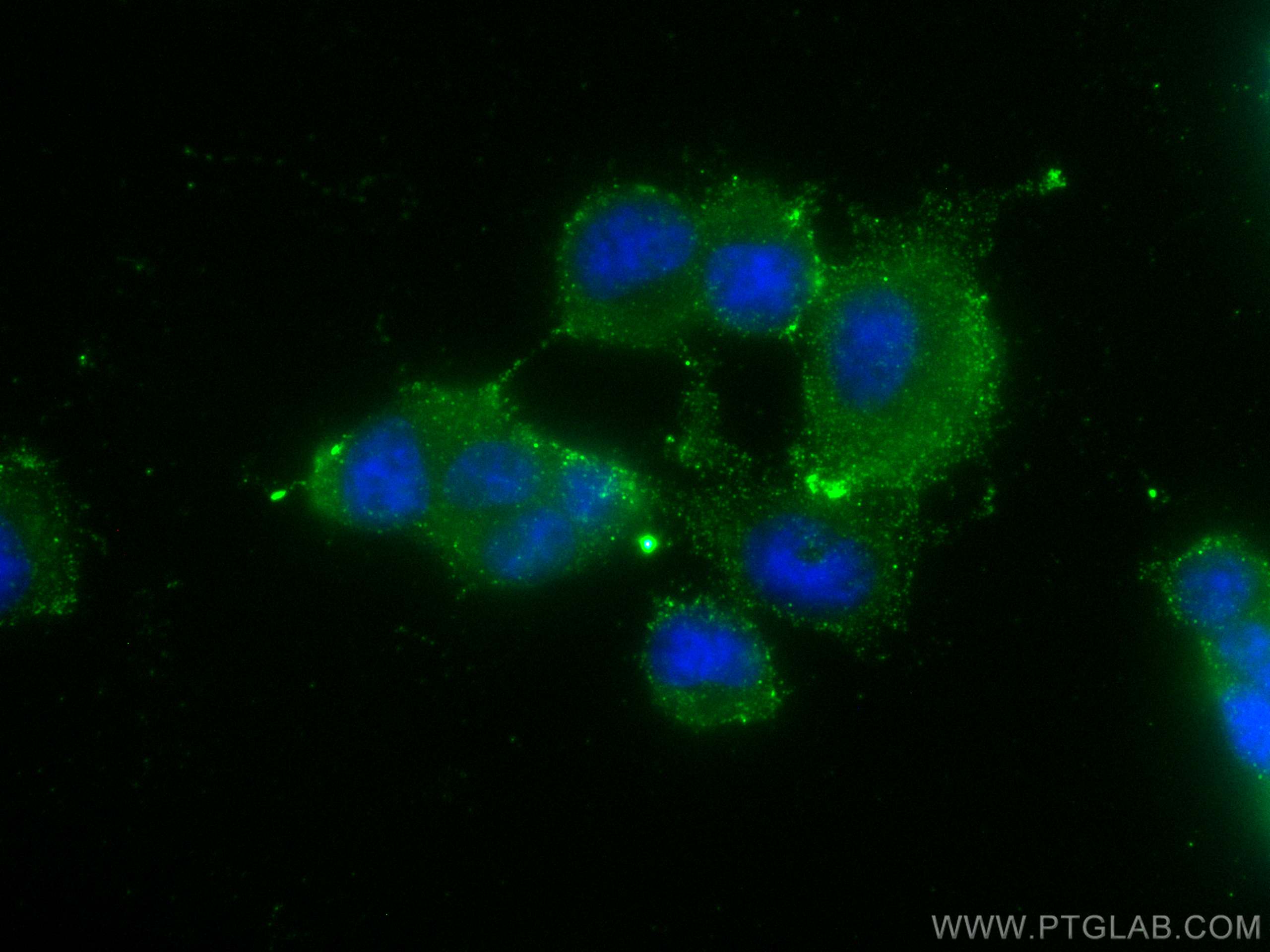 Immunofluorescence (IF) / fluorescent staining of PC-12 cells using KIF5A Polyclonal antibody (21186-1-AP)