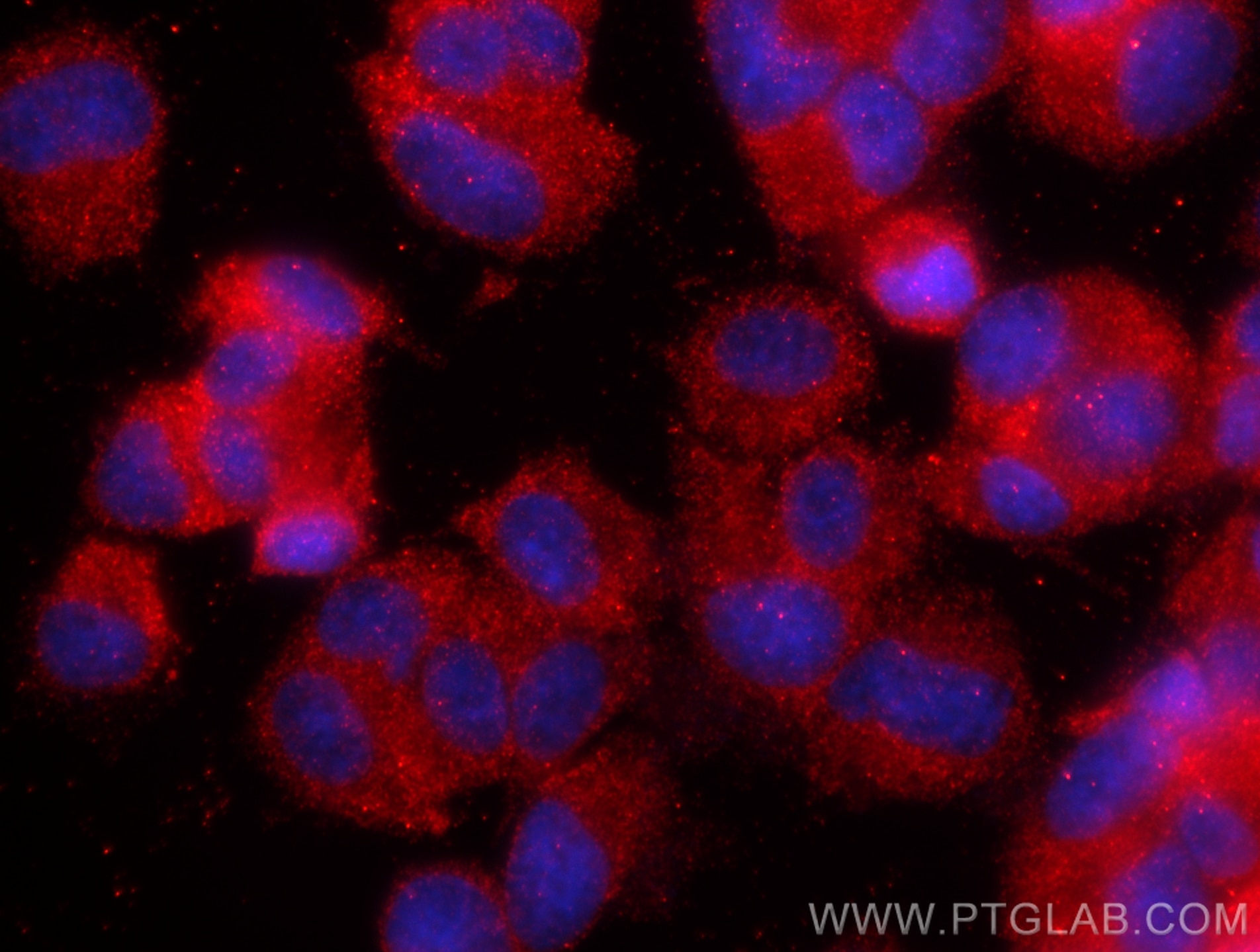 Immunofluorescence (IF) / fluorescent staining of PC-12 cells using KIF5A Polyclonal antibody (21186-1-AP)