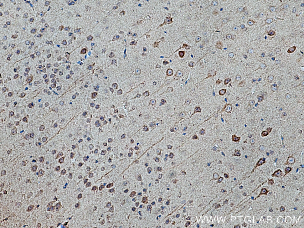 Immunohistochemistry (IHC) staining of mouse brain tissue using KIF5A Polyclonal antibody (21186-1-AP)
