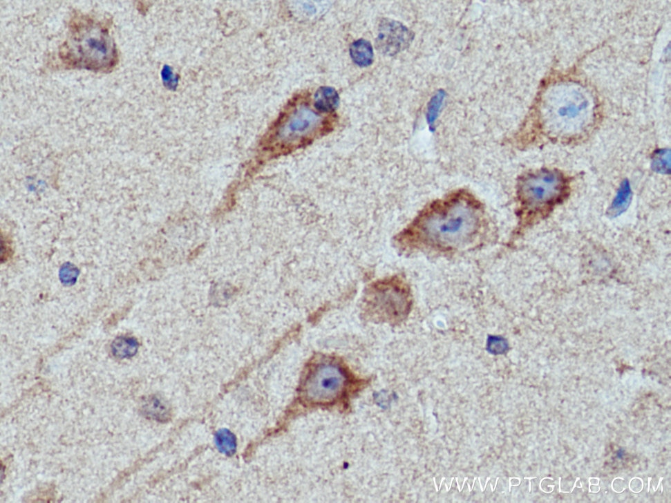 Immunohistochemistry (IHC) staining of mouse brain tissue using KIF5A Polyclonal antibody (21186-1-AP)