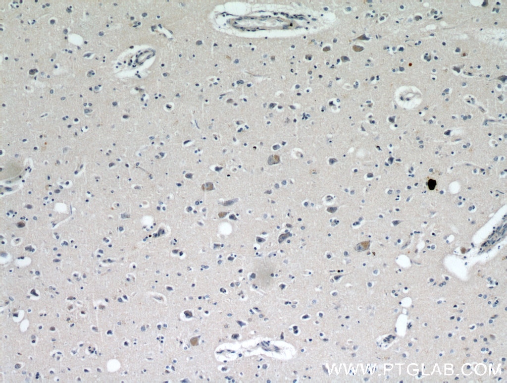 Immunohistochemistry (IHC) staining of human brain tissue using KIF5A Polyclonal antibody (21186-1-AP)