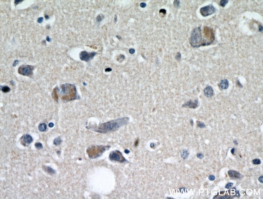 IHC staining of human brain using 21186-1-AP