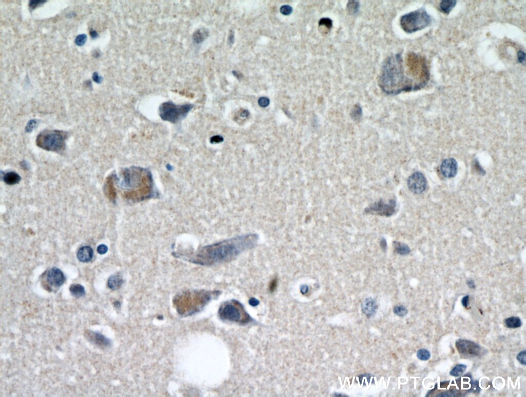 Immunohistochemistry (IHC) staining of human brain tissue using KIF5A Polyclonal antibody (21186-1-AP)