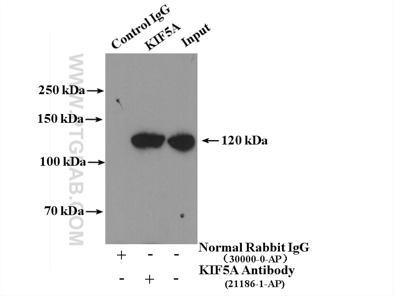 Immunoprecipitation (IP) experiment of mouse brain tissue using KIF5A Polyclonal antibody (21186-1-AP)