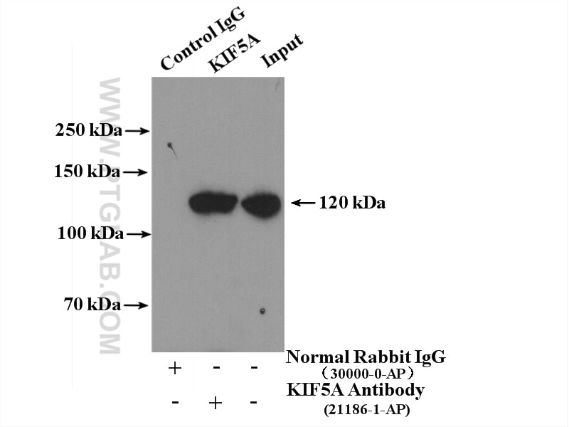 IP experiment of mouse brain using 21186-1-AP