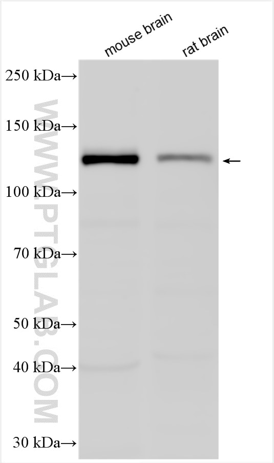 Western Blot (WB) analysis of various lysates using KIF5A Polyclonal antibody (21186-1-AP)