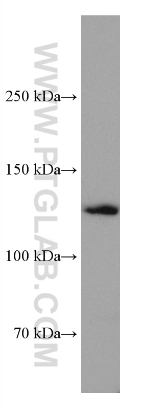 Western Blot (WB) analysis of pig brain tissue using KIF5A Monoclonal antibody (67009-1-Ig)