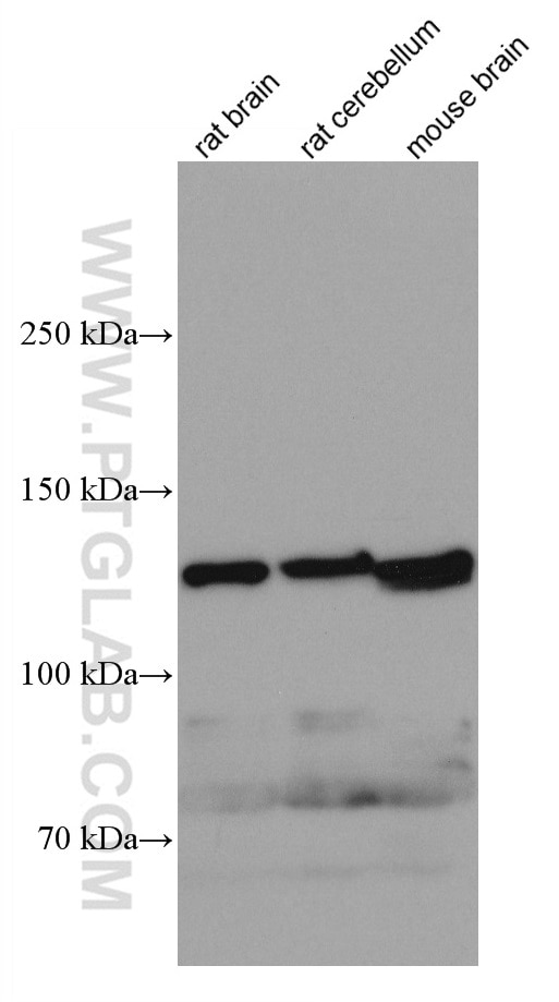 Western Blot (WB) analysis of various lysates using KIF5A Monoclonal antibody (67009-1-Ig)