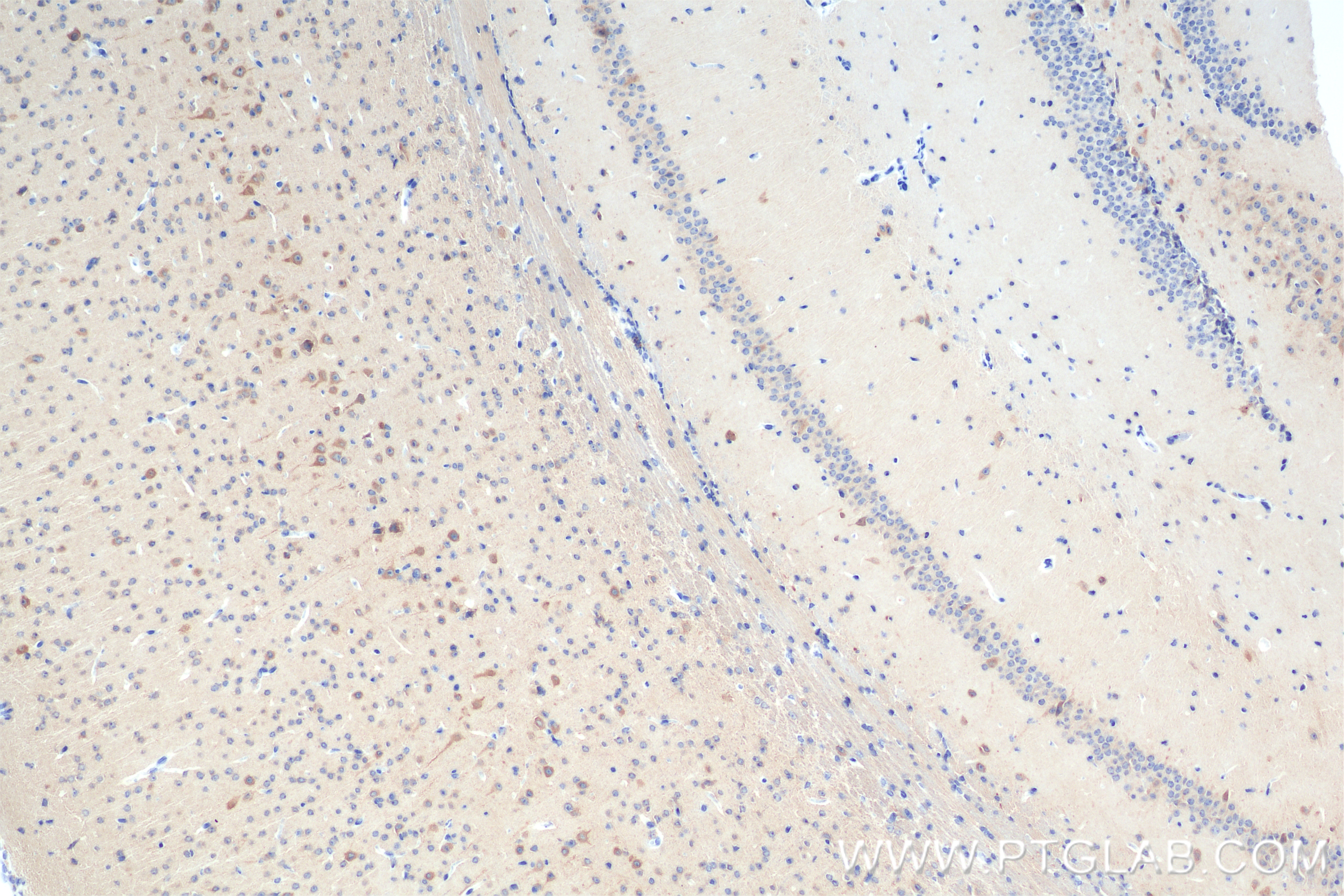 Immunohistochemistry (IHC) staining of mouse brain tissue using KIF5A Recombinant antibody (84013-4-RR)