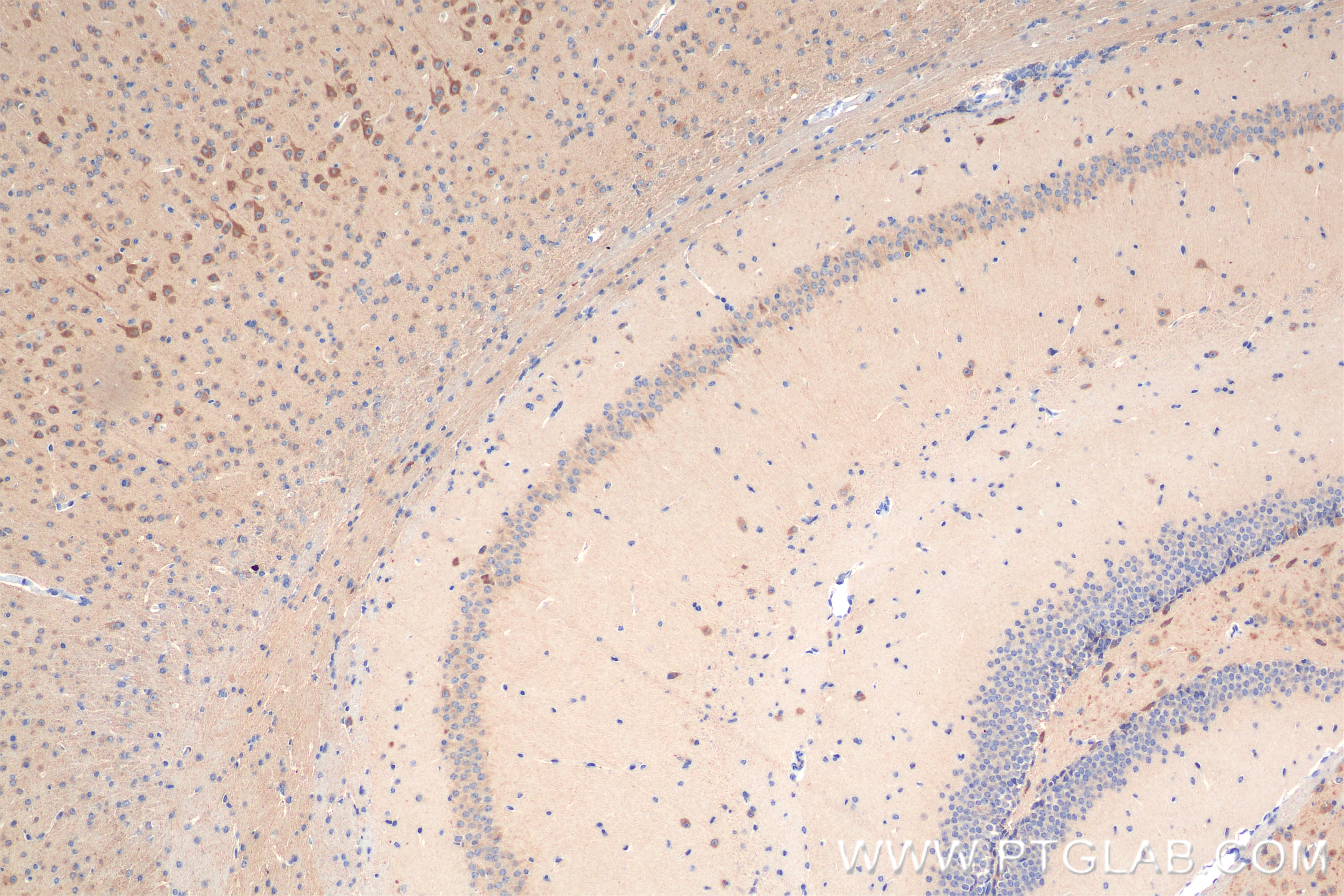 Immunohistochemistry (IHC) staining of mouse brain tissue using KIF5A Recombinant antibody (84013-5-RR)