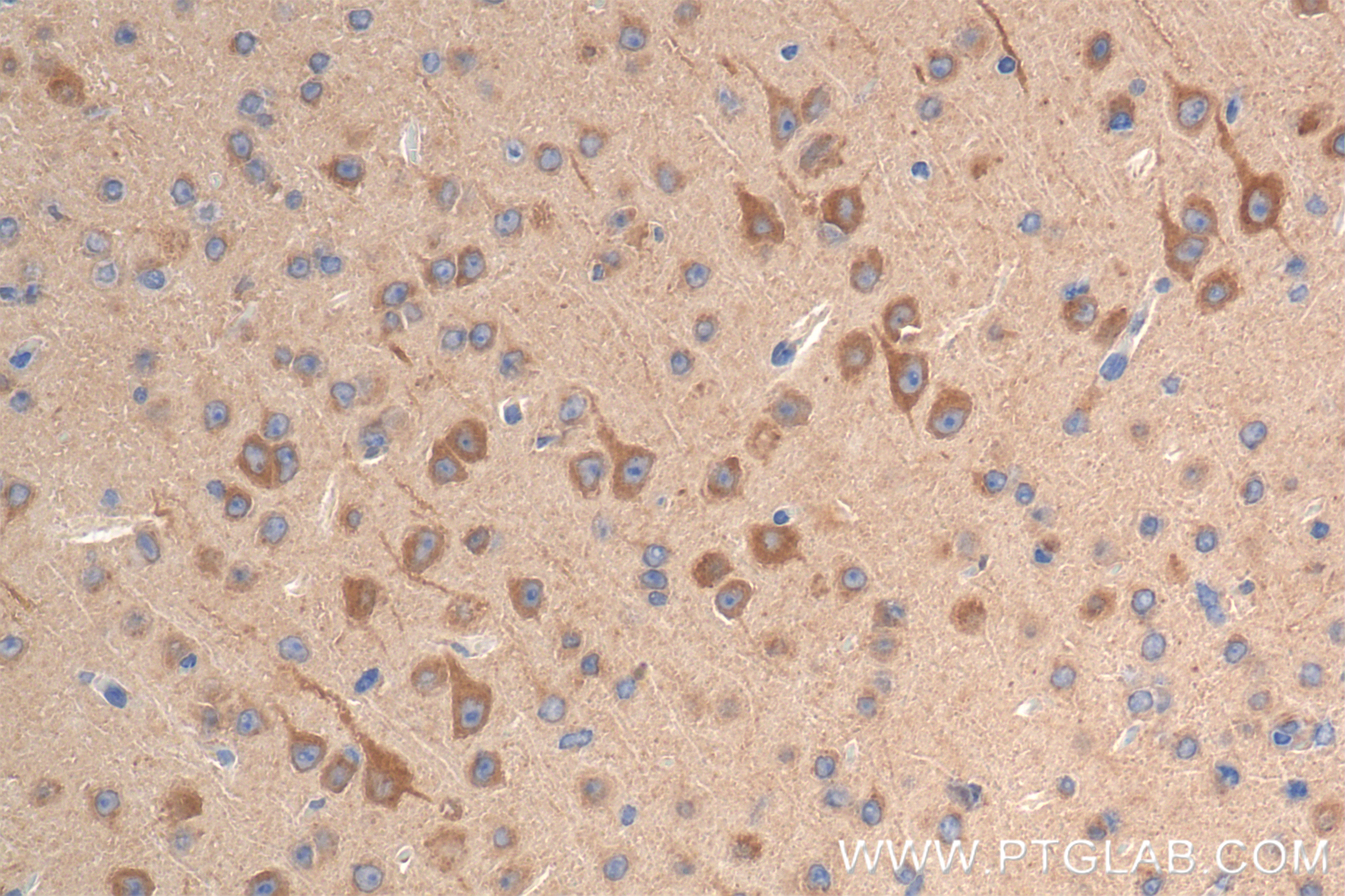Immunohistochemistry (IHC) staining of mouse brain tissue using KIF5A Recombinant antibody (84013-5-RR)