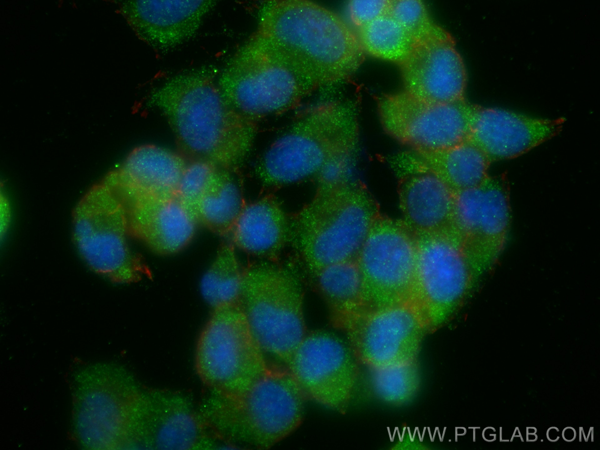 Immunofluorescence (IF) / fluorescent staining of PC-12 cells using Multi-rAb™ KIF5A Multi-Recombinant antibody (RMX00017)