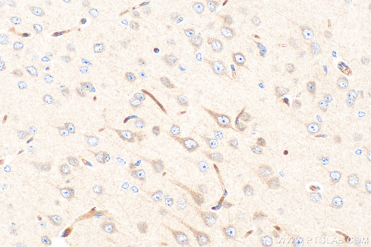 Immunohistochemistry (IHC) staining of mouse brain tissue using Multi-rAb™ KIF5A Multi-Recombinant antibody (RMX00017)