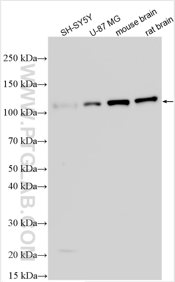 Western Blot (WB) analysis of various lysates using Multi-rAb™ KIF5A Multi-Recombinant antibody (RMX00017)