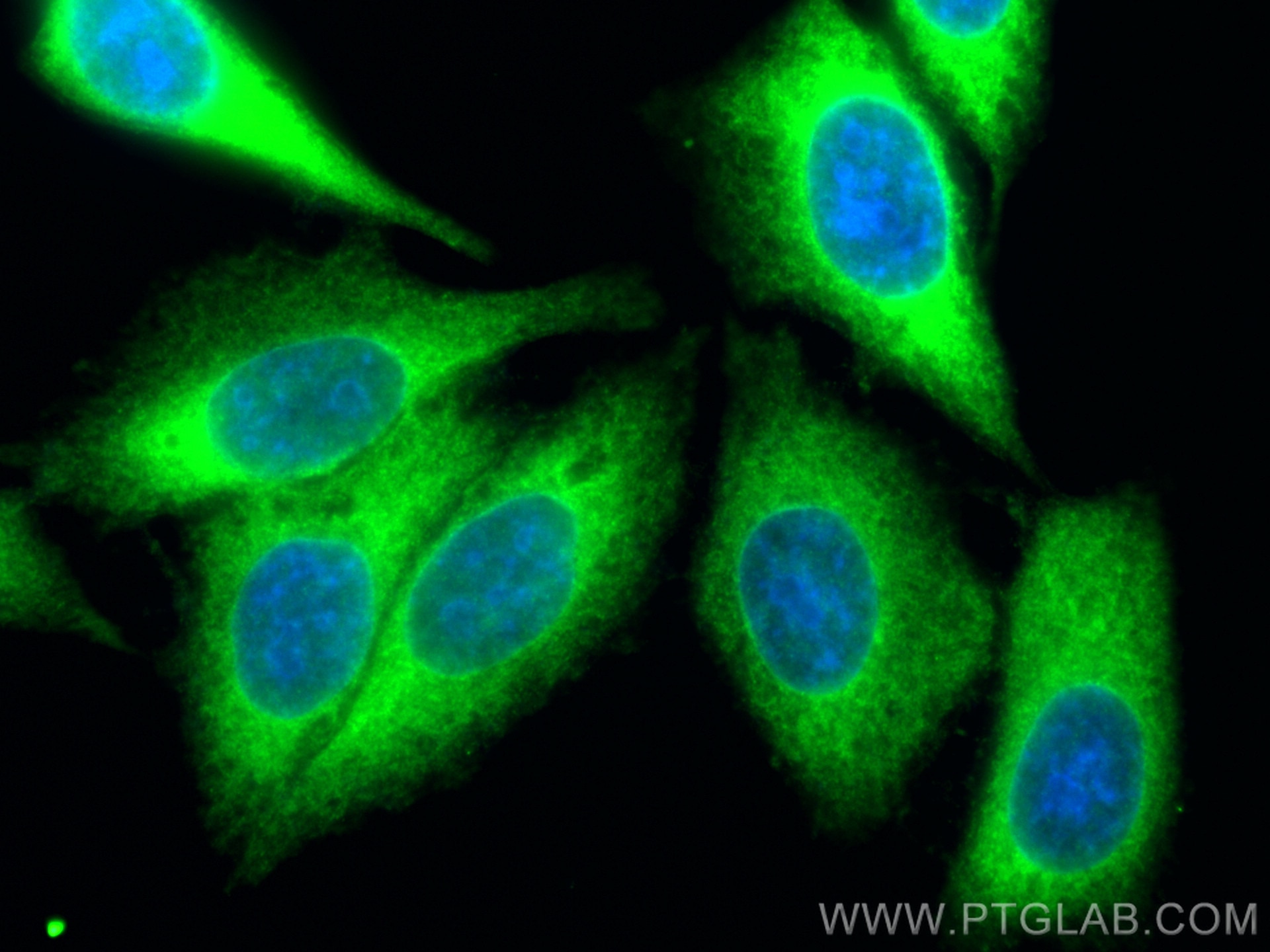 Immunofluorescence (IF) / fluorescent staining of HepG2 cells using KIF5B Polyclonal antibody (21632-1-AP)