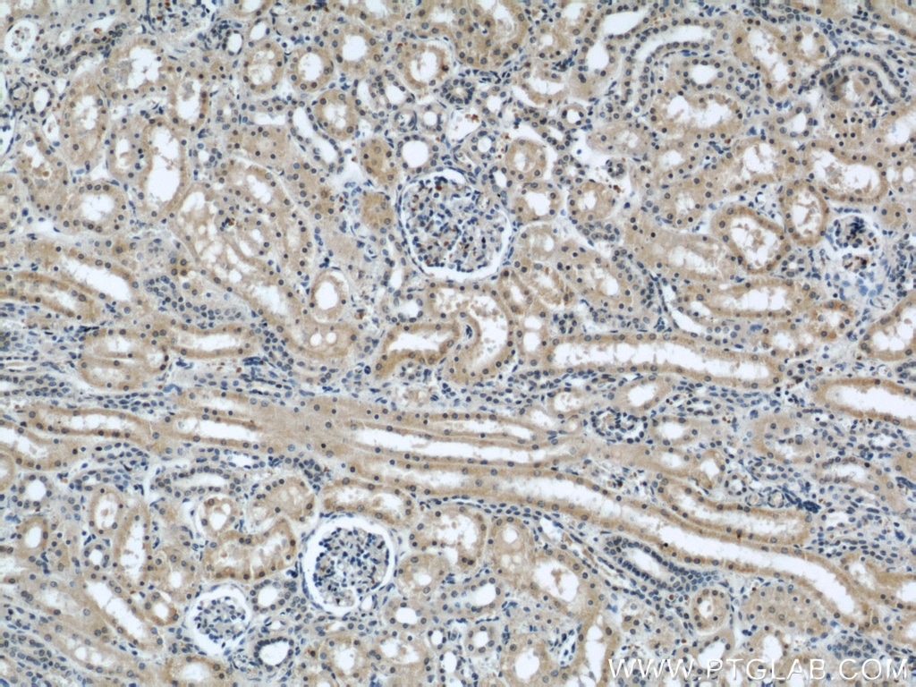 Immunohistochemistry (IHC) staining of human kidney tissue using KIF5B Polyclonal antibody (21632-1-AP)
