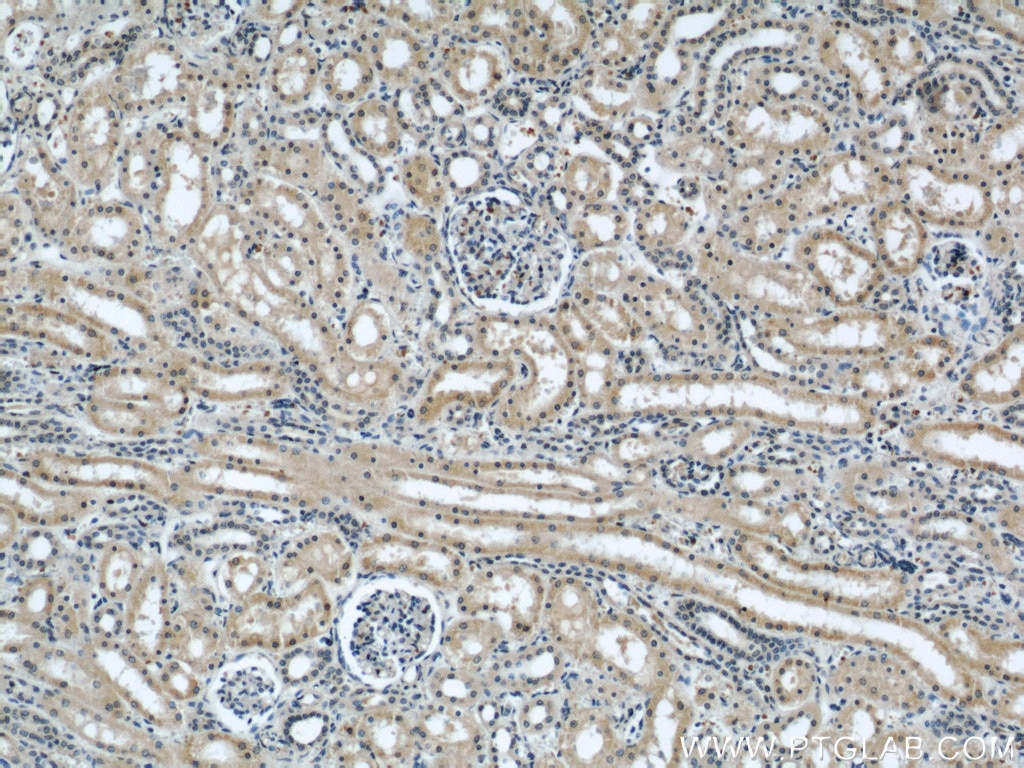 IHC staining of human kidney using 21632-1-AP