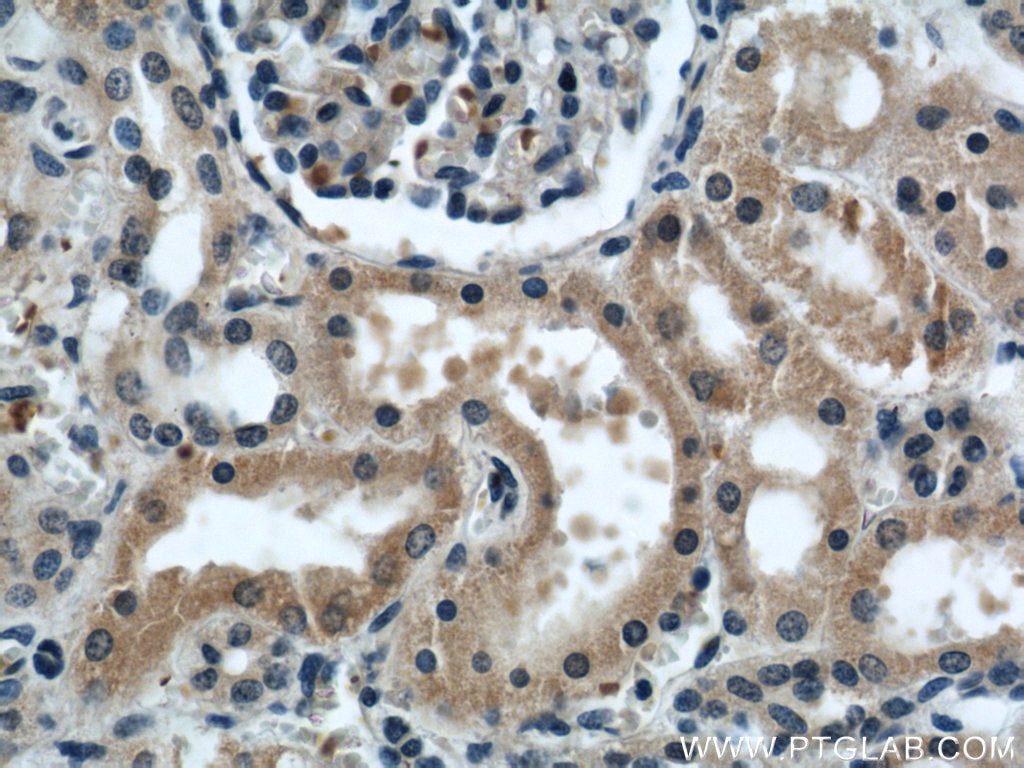 Immunohistochemistry (IHC) staining of human kidney tissue using KIF5B Polyclonal antibody (21632-1-AP)