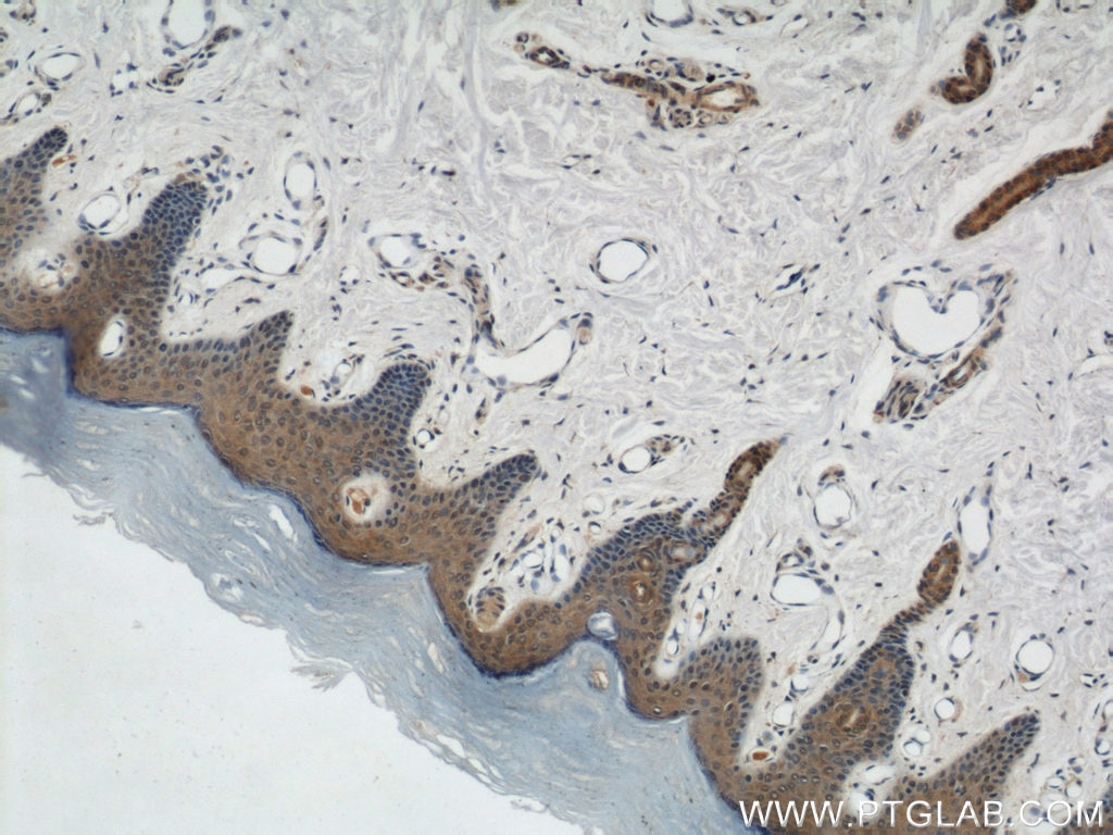 Immunohistochemistry (IHC) staining of human skin tissue using KIF5B Polyclonal antibody (21632-1-AP)