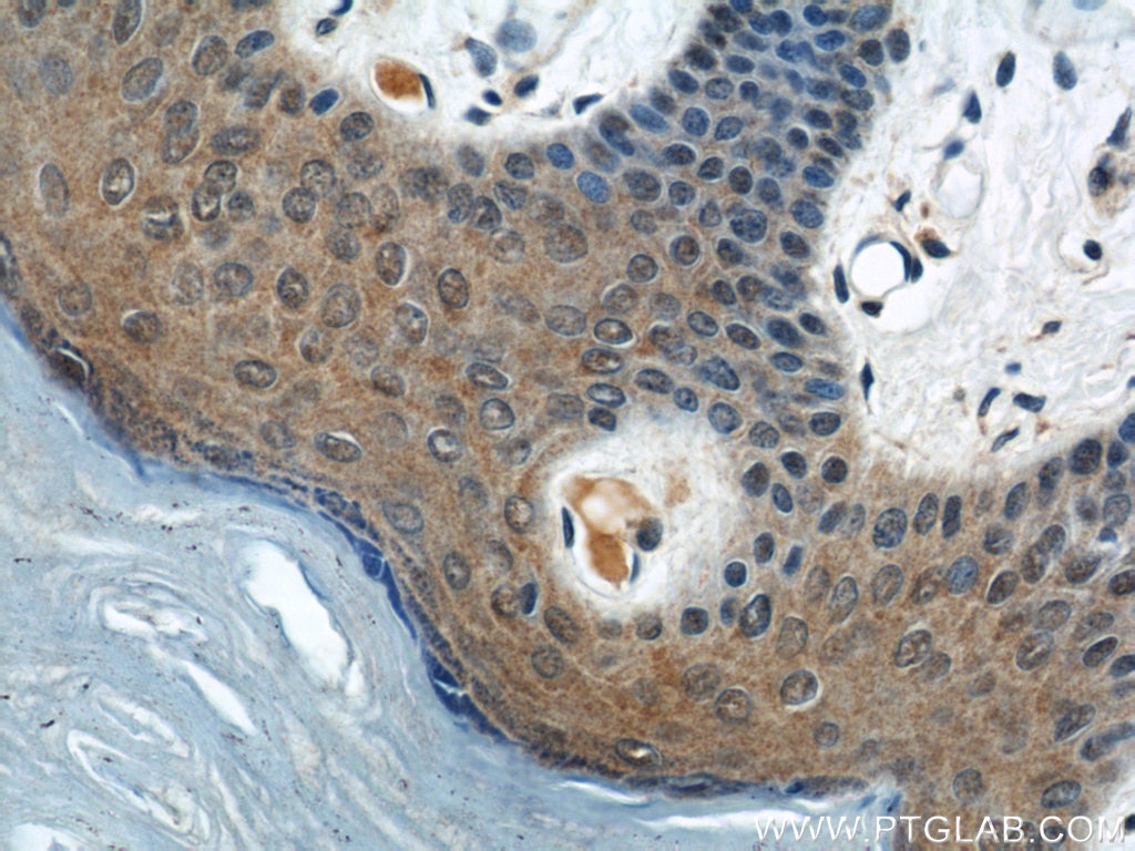 Immunohistochemistry (IHC) staining of human skin tissue using KIF5B Polyclonal antibody (21632-1-AP)