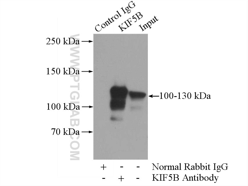 Immunoprecipitation (IP) experiment of HepG2 cells using KIF5B Polyclonal antibody (21632-1-AP)