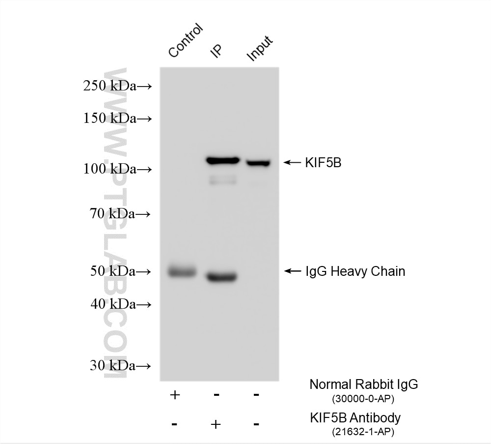 IP result of anti-KIF5B (IP:21632-1-AP, 4ug; Detection:21632-1-AP 1:20000) with HepG2 cells lysate 1400 ug. Immunoprecipitation (IP) experiment of HepG2 cells using KIF5B Polyclonal antibody (21632-1-AP)
