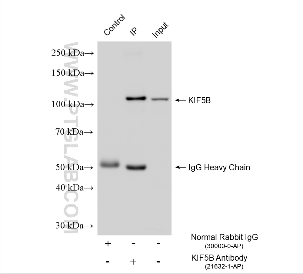 IP result of anti-KIF5B (IP:21632-1-AP, 4ug; Detection:21632-1-AP 1:20000) with mouse heart tissue lysate 1920 ug. Immunoprecipitation (IP) experiment of mouse heart tissue using KIF5B Polyclonal antibody (21632-1-AP)