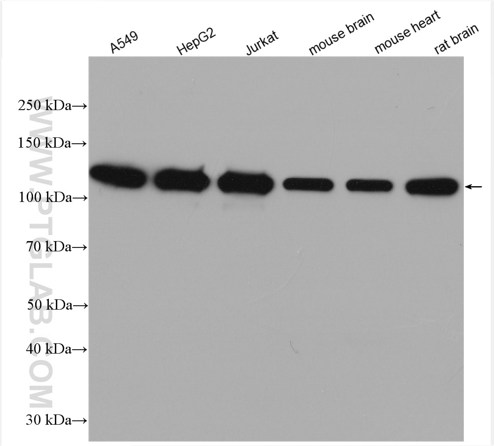 Western Blot (WB) analysis of A549 cells using KIF5B Polyclonal antibody (21632-1-AP)