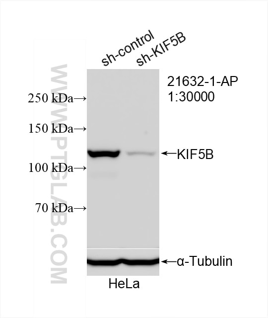 Western Blot (WB) analysis of HeLa cells using KIF5B Polyclonal antibody (21632-1-AP)