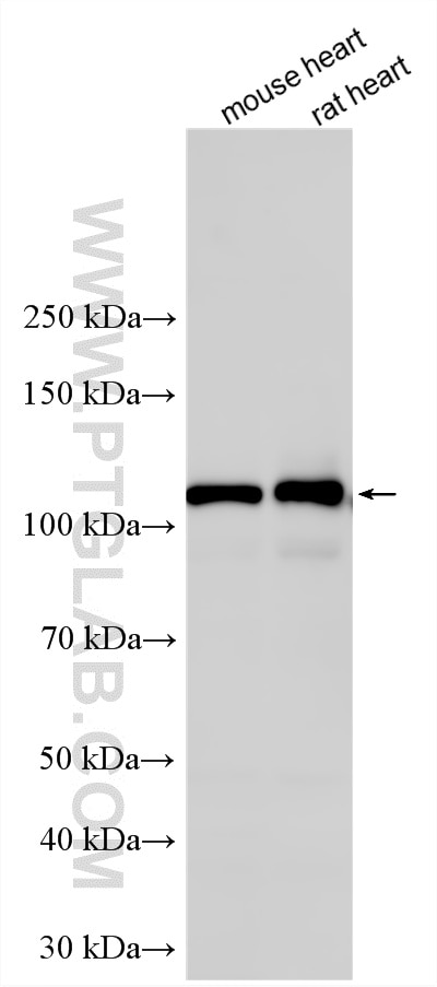 Western Blot (WB) analysis of various lysates using KIF5B Polyclonal antibody (21632-1-AP)