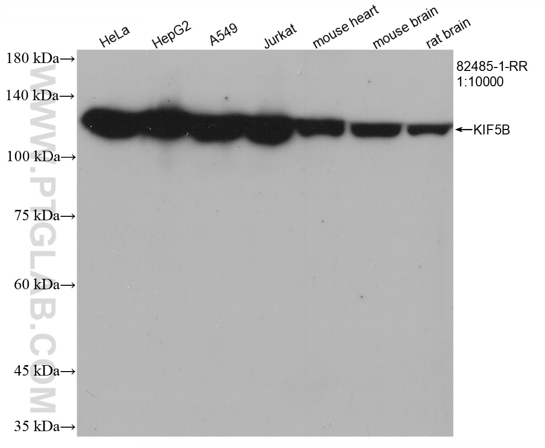 Western Blot (WB) analysis of various lysates using KIF5B Recombinant antibody (82485-1-RR)