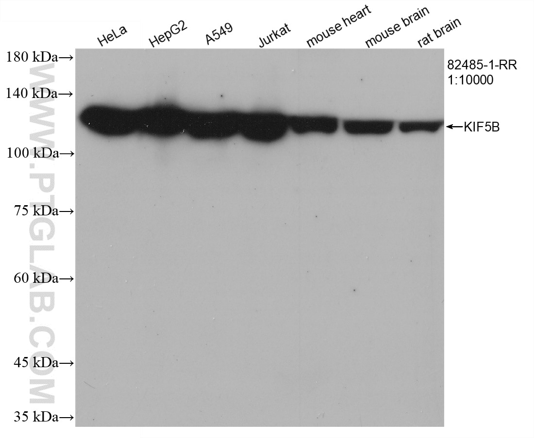 WB analysis using 82485-1-RR