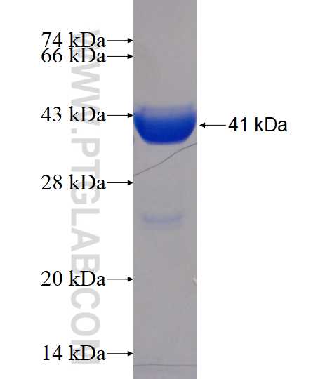 KIF5B fusion protein Ag16250 SDS-PAGE