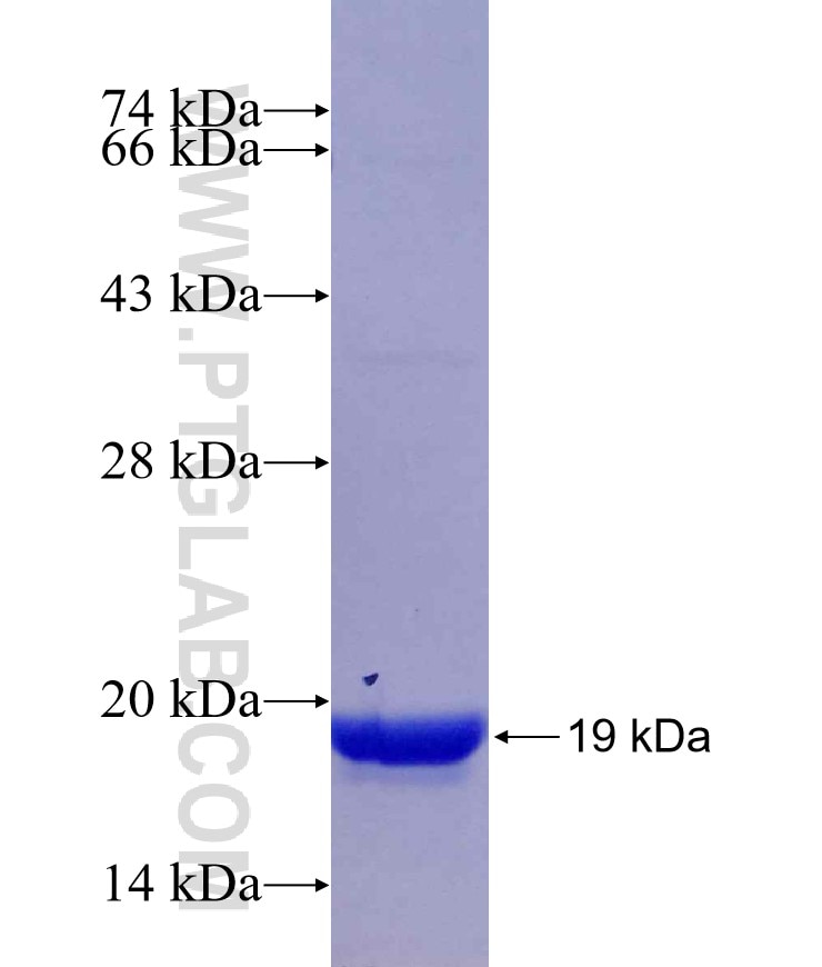 KIF5B fusion protein Ag17715 SDS-PAGE