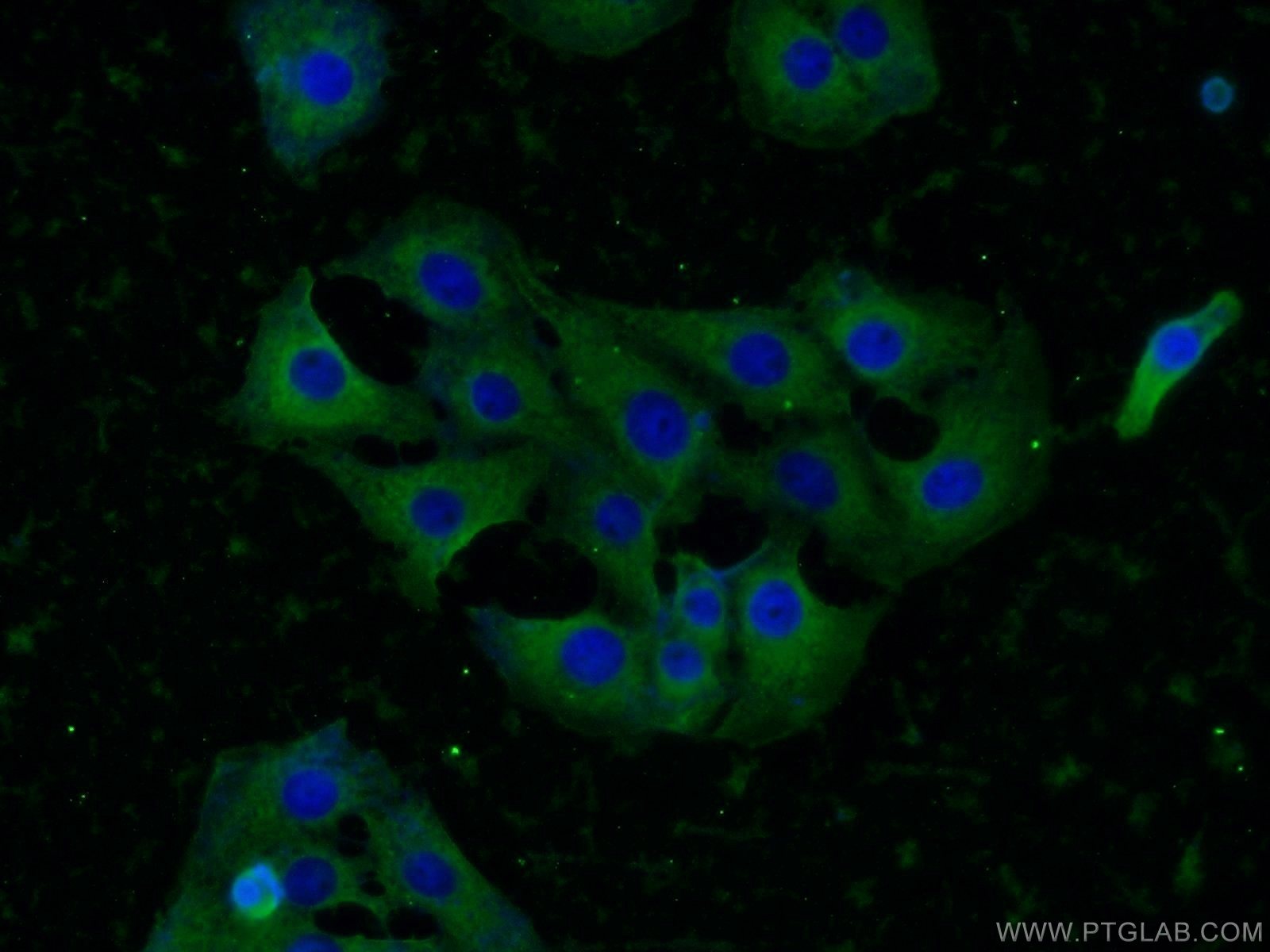 Immunofluorescence (IF) / fluorescent staining of SH-SY5Y cells using KIF5C Polyclonal antibody (25897-1-AP)