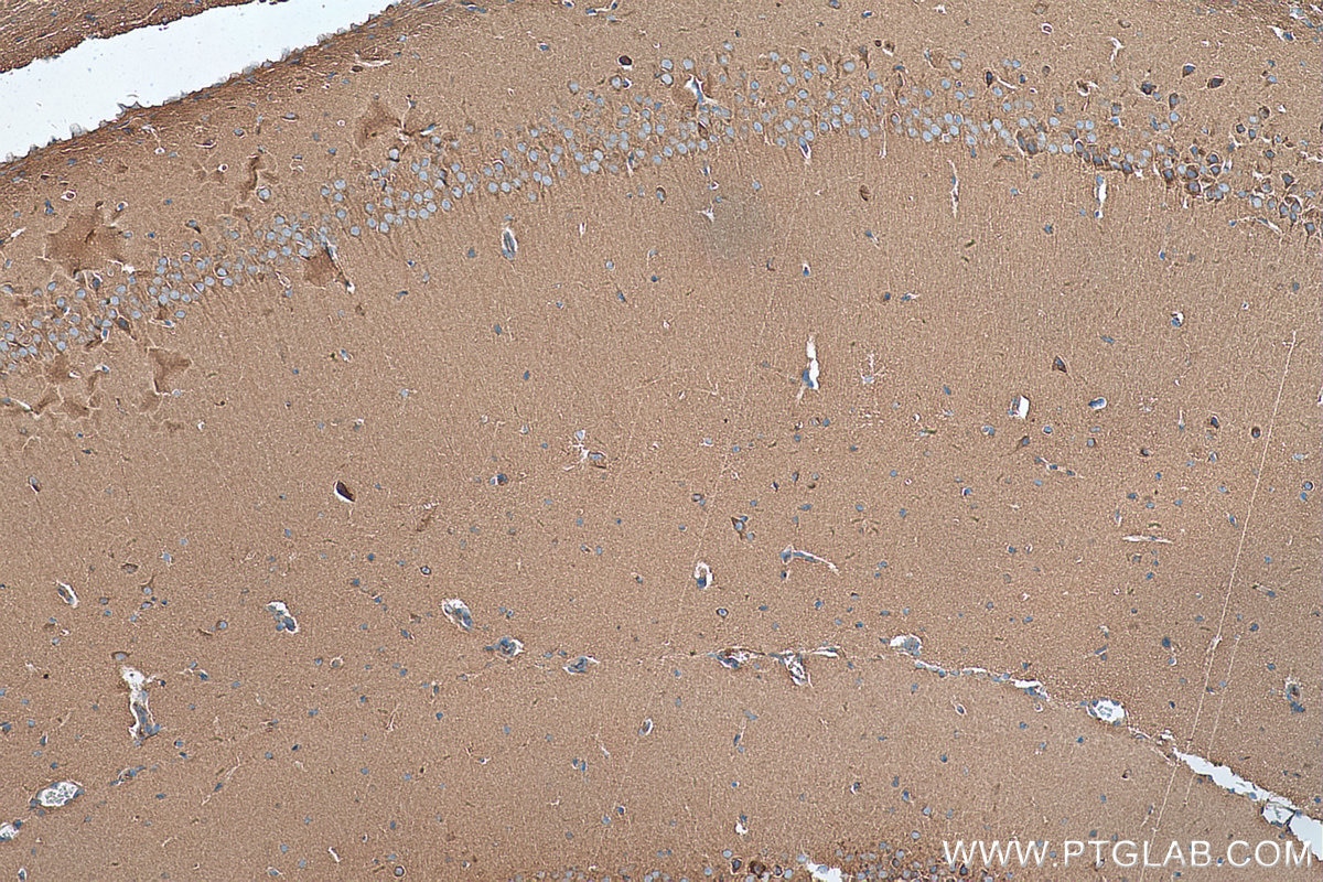 Immunohistochemistry (IHC) staining of mouse brain tissue using KIF5C Polyclonal antibody (25897-1-AP)