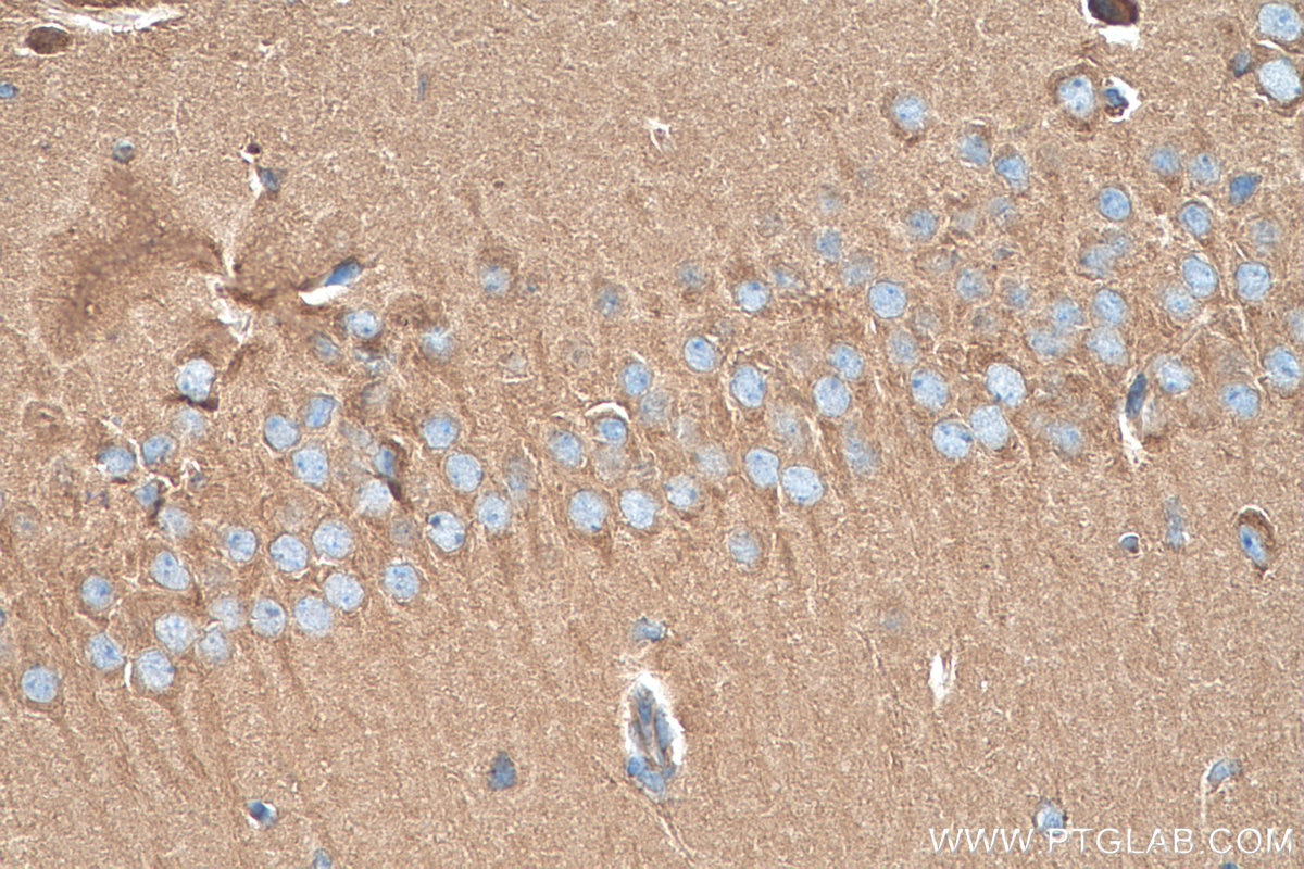 Immunohistochemistry (IHC) staining of mouse brain tissue using KIF5C Polyclonal antibody (25897-1-AP)