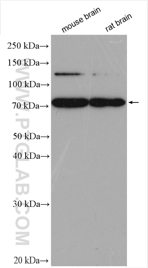 Western Blot (WB) analysis of various lysates using KIF5C Polyclonal antibody (25897-1-AP)