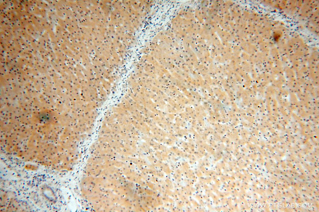 Immunohistochemistry (IHC) staining of human liver tissue using KIF6 Polyclonal antibody (17290-1-AP)