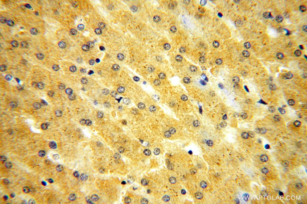 IHC staining of human liver using 17290-1-AP