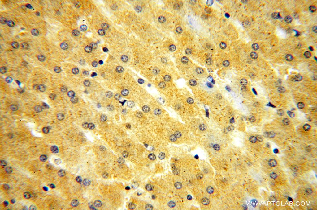 Immunohistochemistry (IHC) staining of human liver tissue using KIF6 Polyclonal antibody (17290-1-AP)