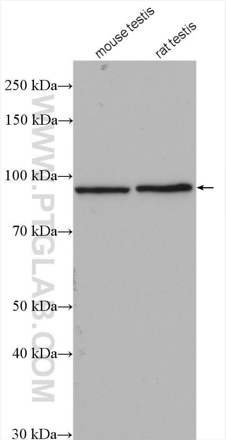 Western Blot (WB) analysis of various lysates using KIF6 Polyclonal antibody (17290-1-AP)