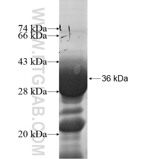 KIF6 fusion protein Ag10743 SDS-PAGE