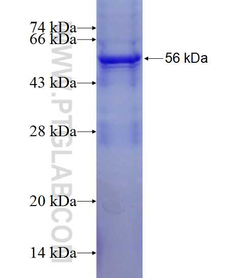 KIF6 fusion protein Ag11164 SDS-PAGE